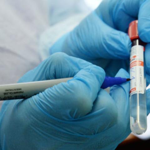 В Крыму не выявлено новых зараженных коронавирусом  